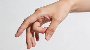 Patient using FingerWeights for hand rehabilitation